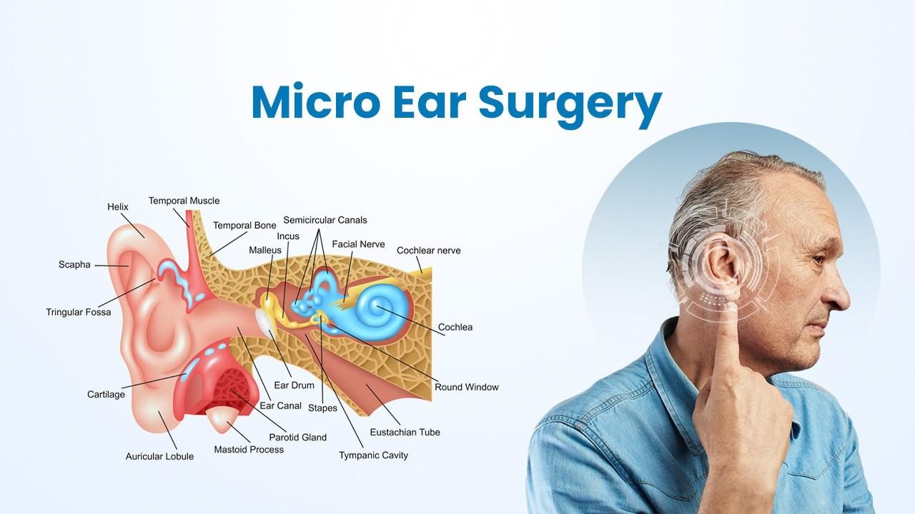 Micro Ear Surgery