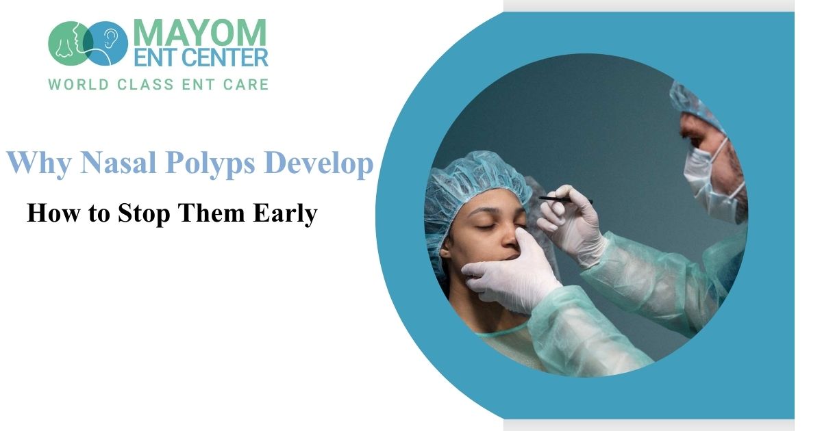 Why Nasal Polyps Develop & How to Stop Them Early