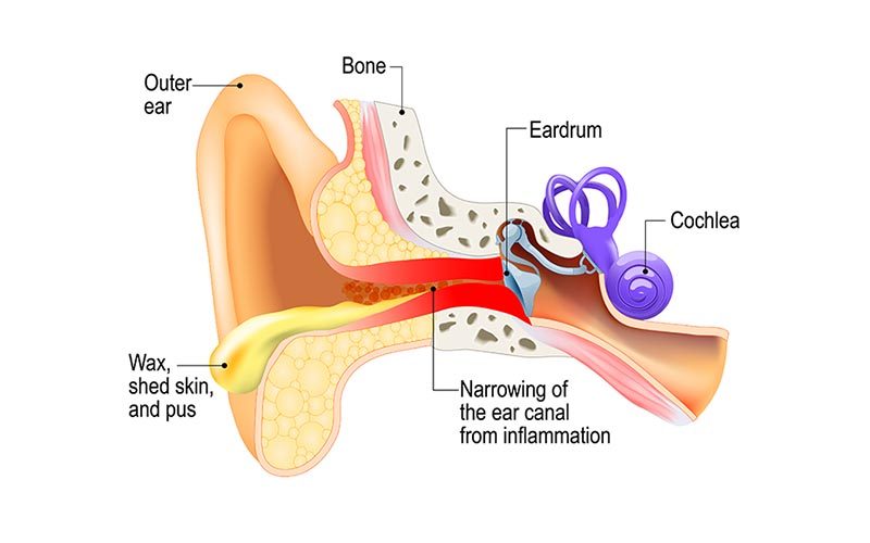 Person experiencing ear discharge issues