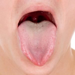 Pediatric ENT in Haryana